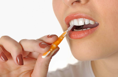 The Ultimate Guide to Interdental Brushes for Superior Oral Care