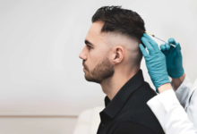 Exploring Hair Transplant Services in Brisbane