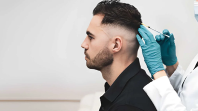 Exploring Hair Transplant Services in Brisbane