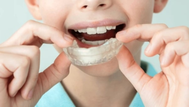 Crowded Teeth to Better Alignment: Understanding Invisalign for Kids