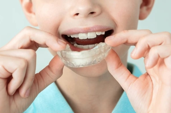 Crowded Teeth to Better Alignment: Understanding Invisalign for Kids