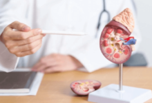Stem Cell Treatment for Kidney Disease: What Patients Need to Know