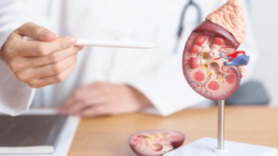 Stem Cell Treatment for Kidney Disease: What Patients Need to Know